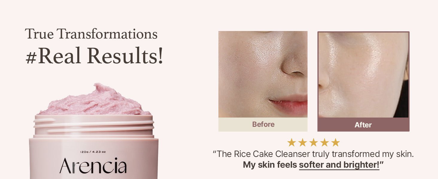 Arencia Fresh Rose Hip Rice Mochi Cleanser | Antioxidant Cleanser for Mature & Dry Skin (120g) - MIMO MART