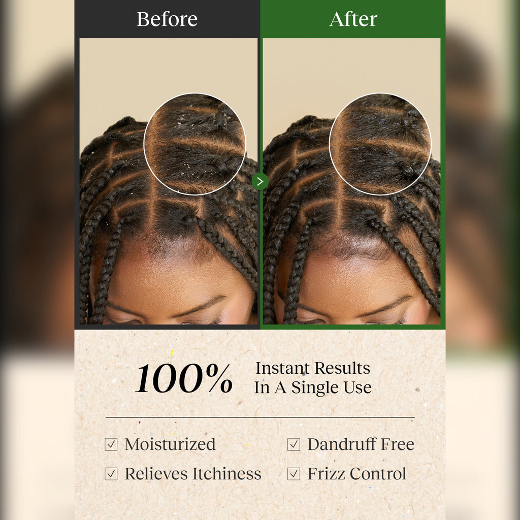 Bephor Braid Rev Scalp Cleansing Toner Pad (5 Pouches × 2 Pads) – No-Rinse Scalp Pads for Braids